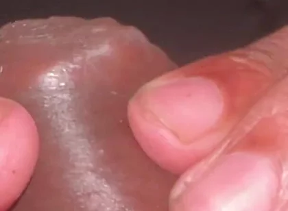 Forskin Play & My Thick Veiny Cock Shooting a Massive Creamy Load