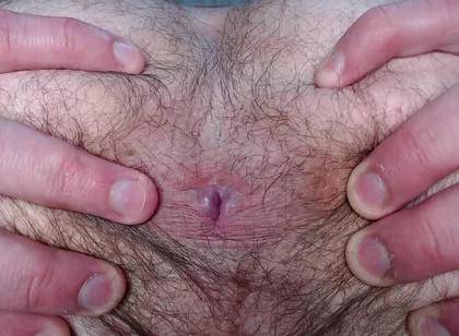 By Popular Demand, I Farted and Showed My Hairy Ass.