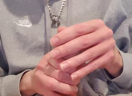 Skinny Lad Pulls Back Skin to Show Bellend