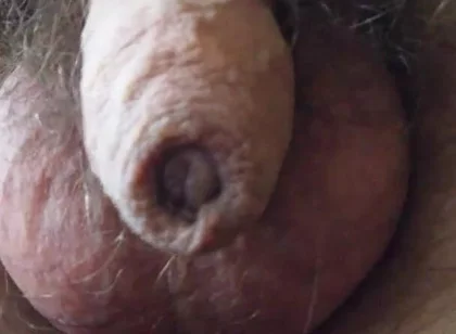 My Penis Walkabout