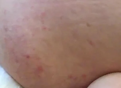 More Hotel Fun