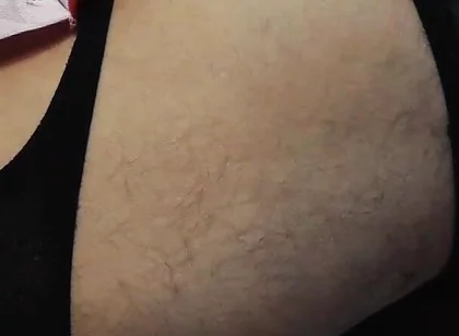 Rot Couch