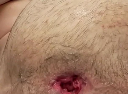 Teen Fisting Gaping Asshole Hard
