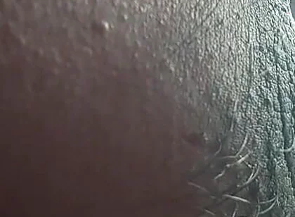 Armpit