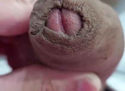 The Head of My Penis