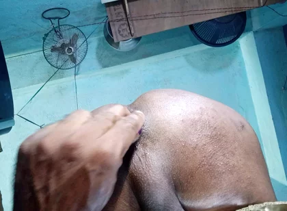 Anal sex