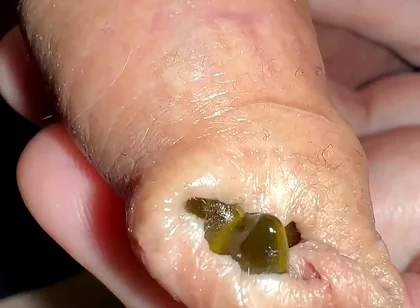 Juicy Small Cock Foreskin Games
