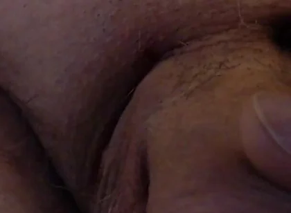 Limping Dick