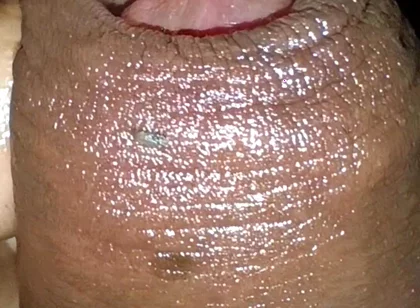 Close-up of Foreskin and Ejaculation in My Pants
