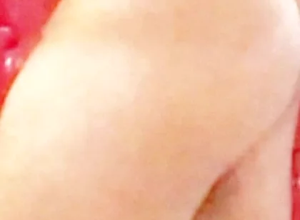 Whip-lash