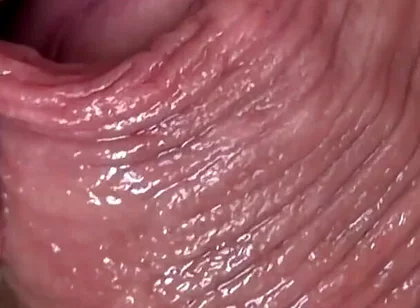 Cocksucker