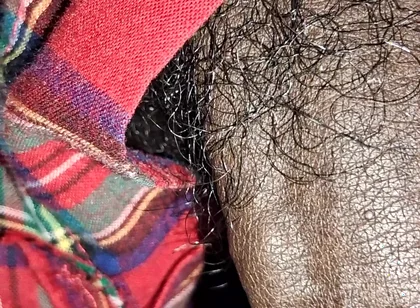 Close up on These Thick Veins