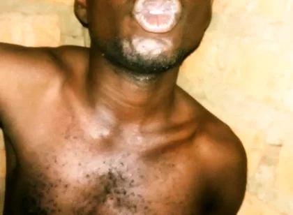 My Great Massaging and Maculation