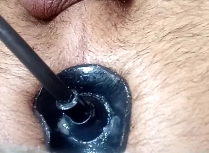 Solo Inflatable Plug