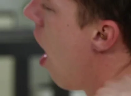 Exposed