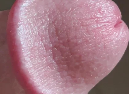 Closeup of Penis with One Vein