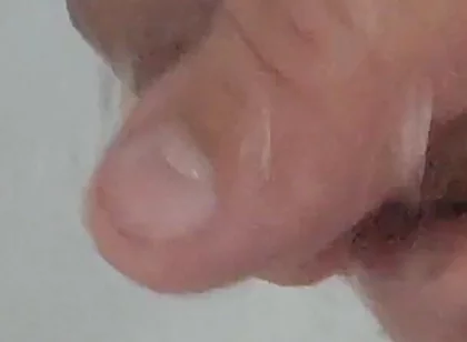 Strong Water in the Foreskin Excites the Glans Precum.