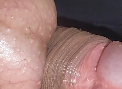 Amazing Upright Rough Venous Frenulum.