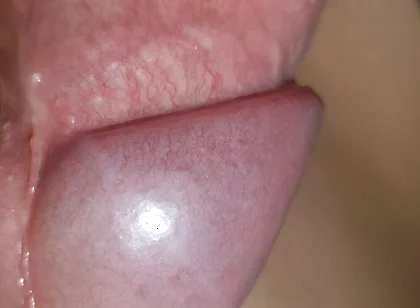 Amazing Upright Rough Venous Frenulum