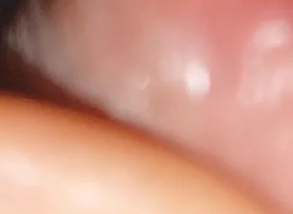 Hot Daddy in Close-up of the Inside of the Glans!