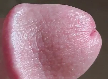Closeup of Penis with One Vein