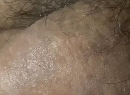 He Is Waking up