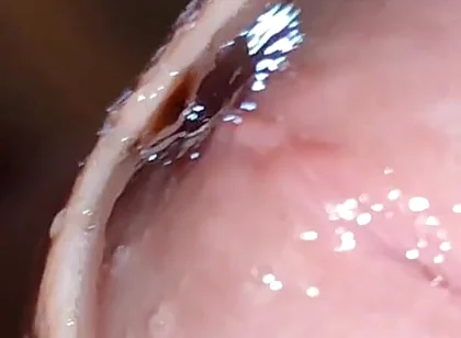 Glans Eye Watering After Intense Fucking.
