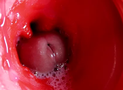 Camera Inside Pussy: Powerful Cum in Pussy! Best Internal Asmr in 4K More Sperm
