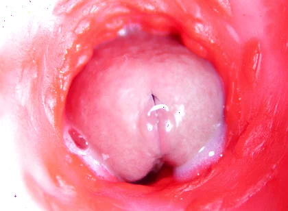 Camera Inside Anal: Almost Cum in Ass! Best Internal Asmr in 4K