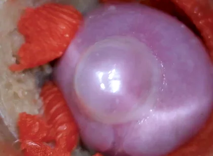 The Camera Inside the Deep Pussy Records a Huge Ejaculation with a Stuck Condom 4K