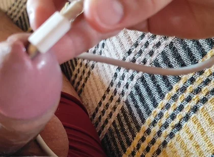 Applying Electric Shocks Inside the Glans.