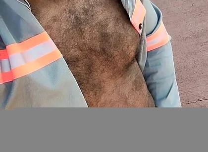 My Hairy Body
