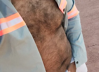 My Hairy Body