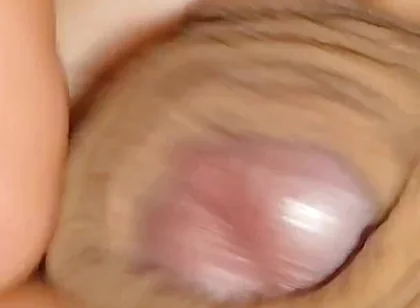 The World's Largest Foreskin Opening and Closing.