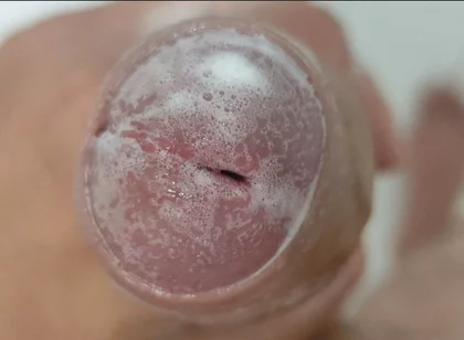 Extreme Burning Sensation Makes the Glans Foam with Arousal.