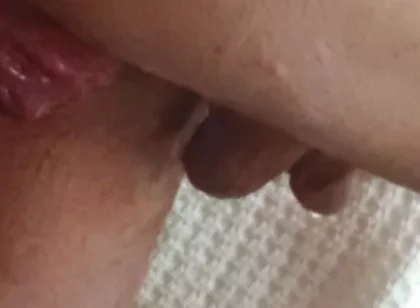 Prolapse and Urine