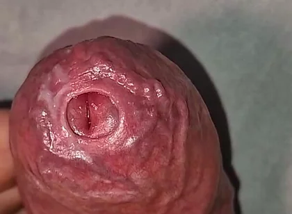 Close up on Phimosis Large Cock, so Hot!