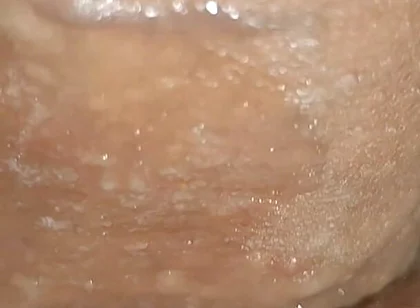 Scrotal Phimosis Results in an Extremely Hot Orgasm.