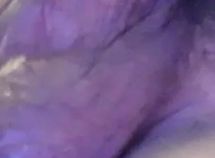 Awesome Balls