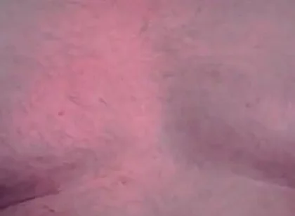 Brust Raus Nippel