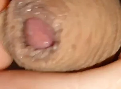 Cumshot of the Largest Phimosis Foreskin in the World.