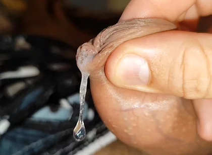 Cumshot of the Largest Phimosis Foreskin in the World.